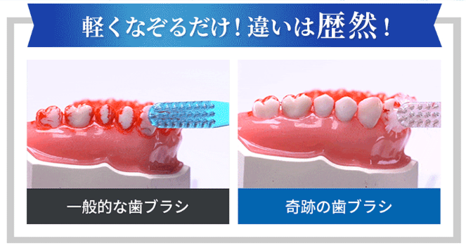 なぞるだけで汚れが落ちる歯ブラシの定期便「奇跡の歯ブラシ」一般的な歯ブラシとの違い